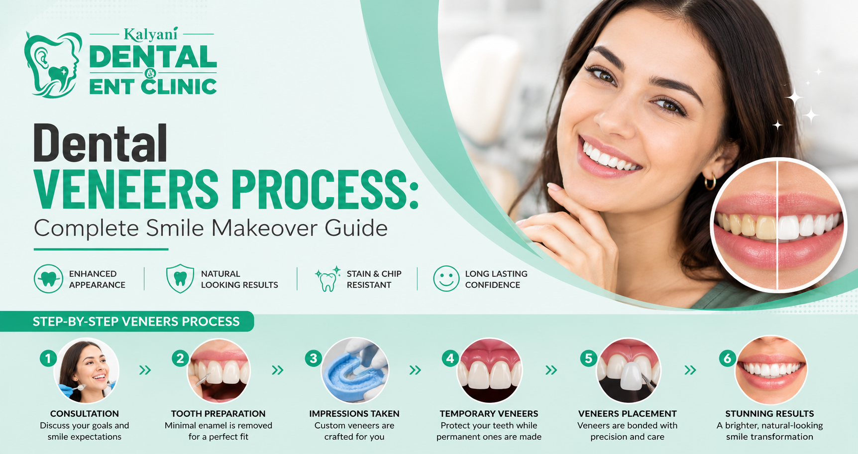 Dental Veneers Process: Complete Smile Makeover Guide